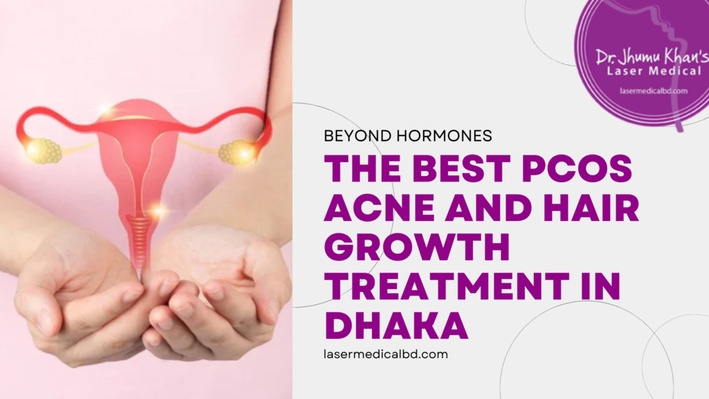 Best PCOS Acne and Hair Growth Treatment in Dhaka